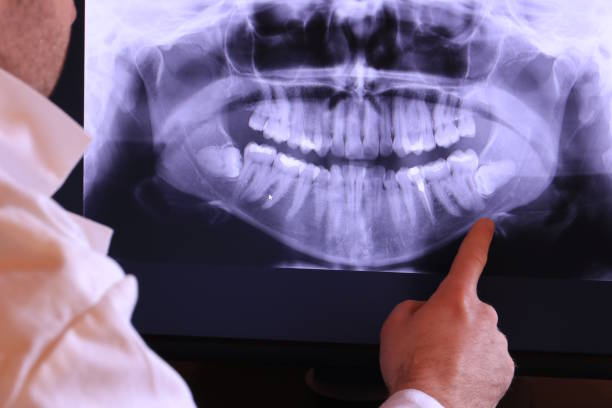 Best Holiday Emergency Dentist in Gervais, OR