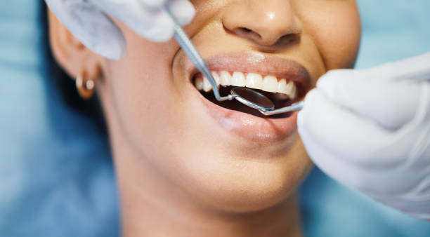 Best Emergency Dental Extractions in Gervais, OR